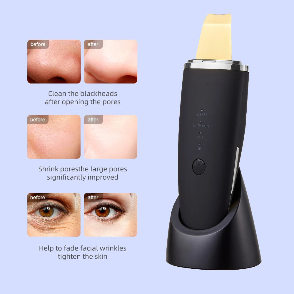 Éclatelle 24K Ultrasonic Skin Scrubber – Deep-Cleansing, EMS Lifting & Ion Therapy