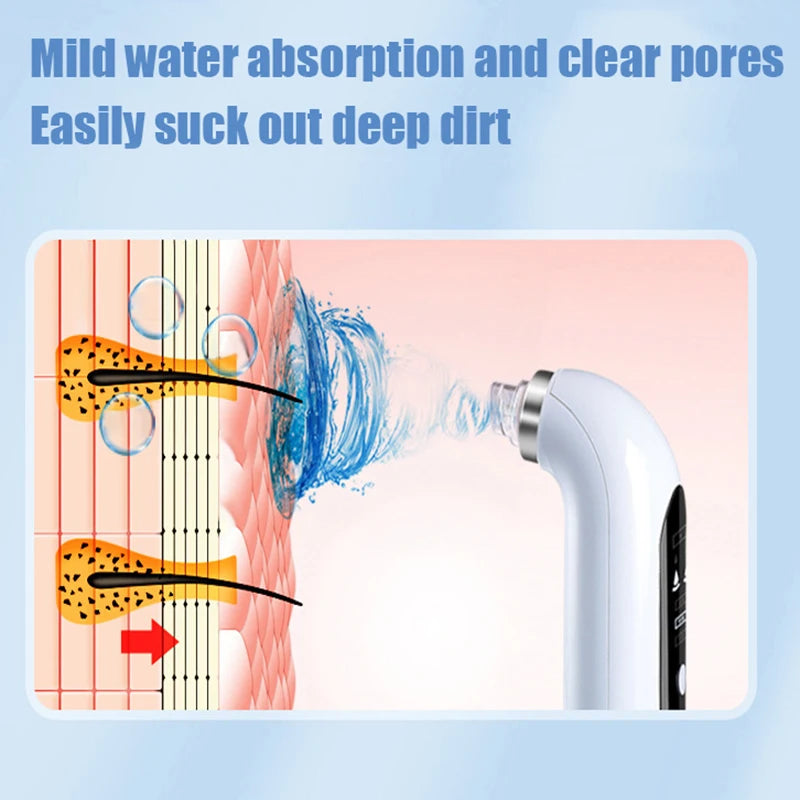 Éclatelle HydroVac Pro – Deep Pore Vacuum Cleanser with Water Circulation
