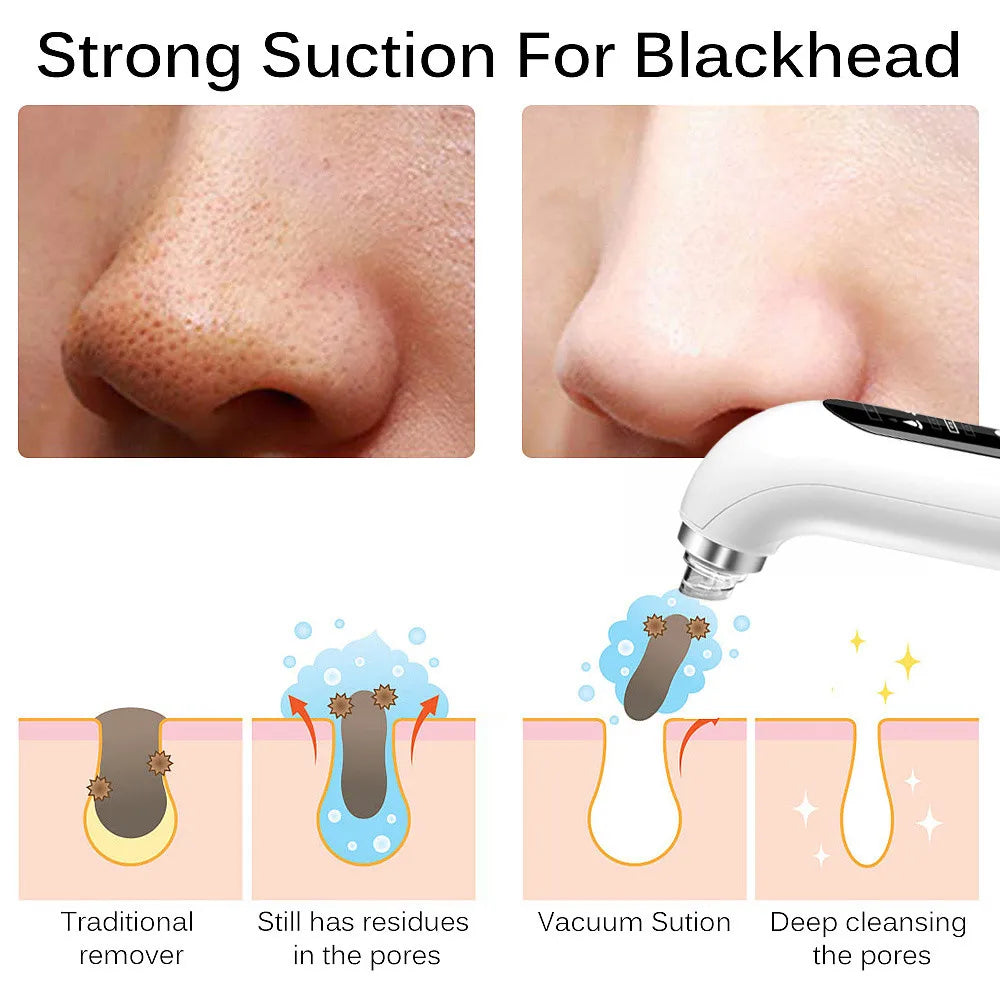 Éclatelle HydroVac Pro – Deep Pore Vacuum Cleanser with Water Circulation