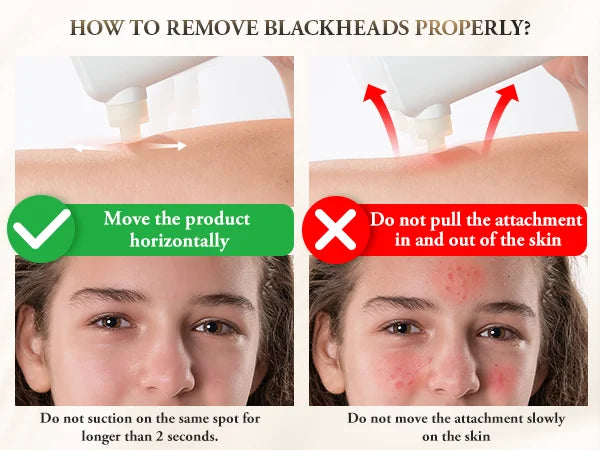 Éclatelle HydroClea Portable Blackhead Remover – Deep Pore Vacuum Cleanser