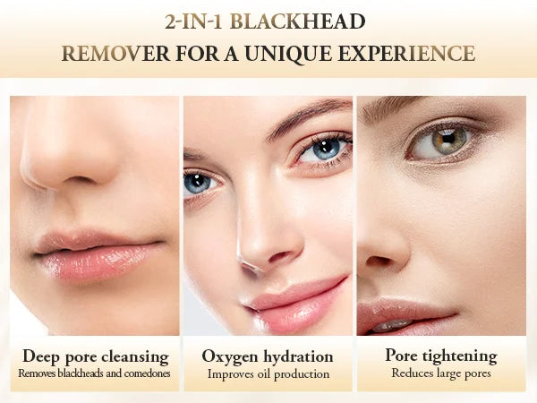 Éclatelle HydroClea Portable Blackhead Remover – Deep Pore Vacuum Cleanser
